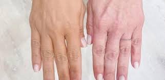 download (20) pele pálida e amarelada sugerindo sintomas de deficiência de vitamina B12