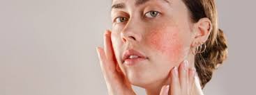 download (72) mulher analisando irritação causada por cosmético