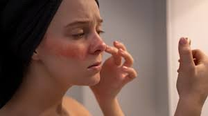 download (2) pele amarelada no rosto de uma pessoa