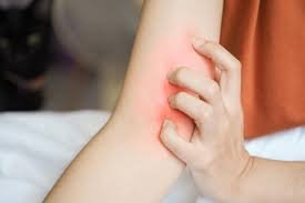 download pessoa coçando o braço à noite na cama