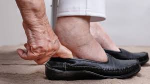 download (56) Calor Intenso: Entenda Por Que Seu Corpo Incha e Retém Líquidos no Verão e Como Aliviar o Desconforto!