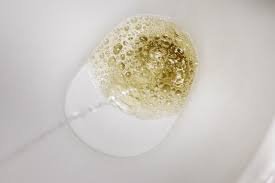 images (4) Urina espumosa no vaso sanitário