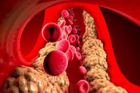 download (16) Exame de sangue avaliando colesterol e lipoproteína(a)