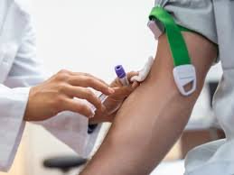 download (17) Exame de sangue mostrando PCR ultrassensível