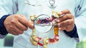 download (40) Não Ignore o Sangue Oculto nas Fezes: Entenda os Sinais Cruciais e Quando Fazer o Exame