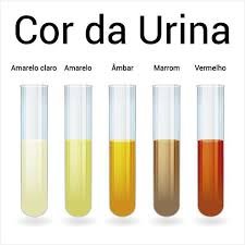 download (43) Escala ilustrada de cores da urina do amarelo claro ao marrom escuro