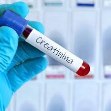 images (11) Exame de sangue com creatinina e taxa de filtração glomerular