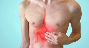 images (28) Hérnia de hiato: sinais e como confirmar