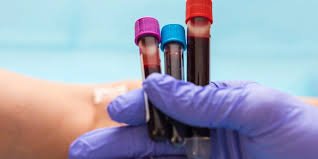 images (5) Exame de sangue mostrando triglicerídeos elevados