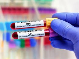 images (6) Exame de colesterol com HDL muito elevado