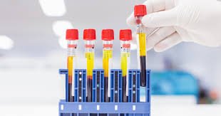 images (8) Exame de sangue mostrando Gama GT elevada