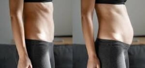 download (12) mulher com sensação de inchaço abdominal e retenção de líquidos