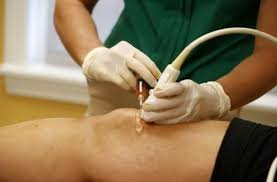 download (24) tratamento de cicatrizes com técnicas de medicina regenerativa