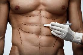 download (31) Abdominoplastia masculina cirurgia estética no abdômen