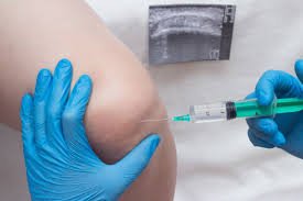 download (8) PRP para dor no joelho