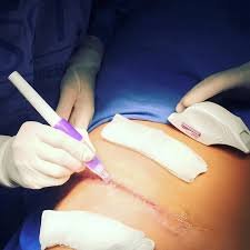 images (3) cicatriz sendo avaliada por médico antes de cirurgia estética