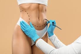 download (13) mulher em recuperação tranquila após cirurgia abdominal