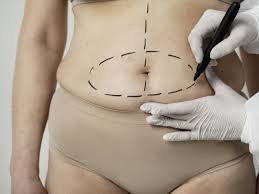 download (27) mulher fazendo avaliação para cirurgia plastica