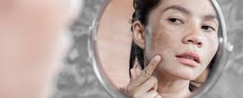 download (28) mulher observando manchas na pele