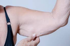 download (3) sarcopenia em mulheres jovens