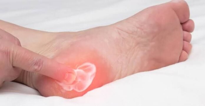 images (10) fascite plantar