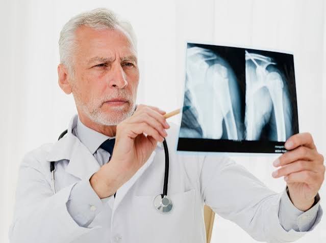 images (2) osteopenia
